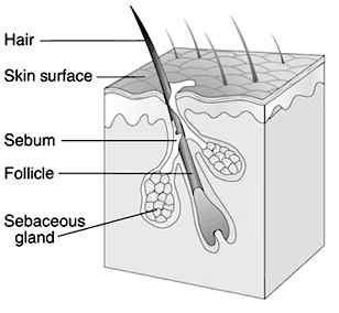 Différence entre les pores et les follicules pileux