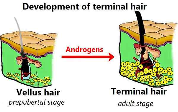 Perbedaan antara rambut terminal dan rambut vellus